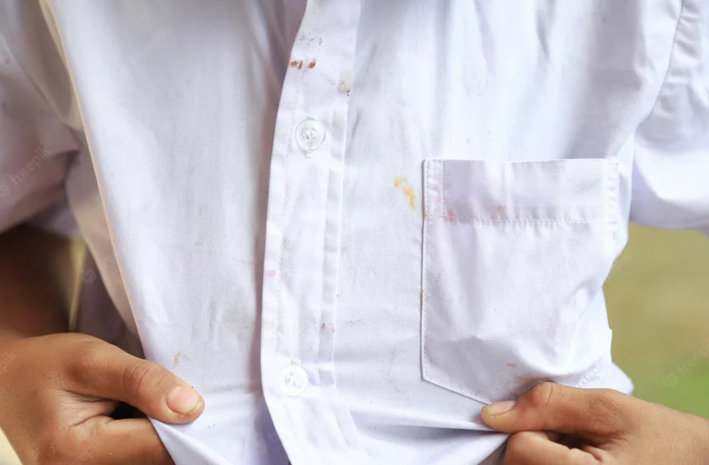 چگونه لباسهای سفید را دوباره سفید کنیم؟ 2 چگونه لکه های لباس های سفید را از بین ببریم